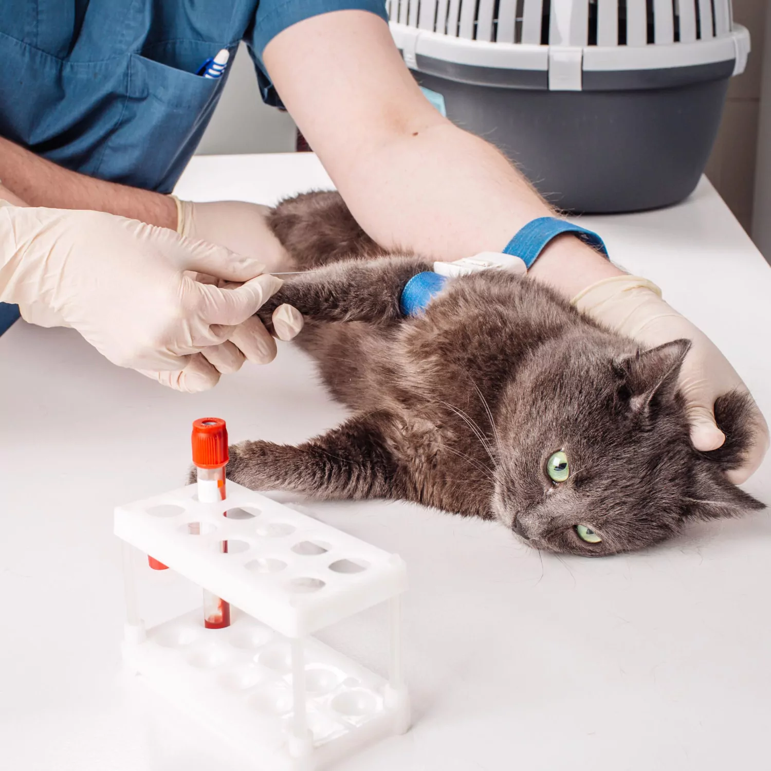 Hematoloji ve Transfüzyon